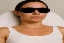 Laser treatment: Smart recovery that’s fast, calm, and complication light