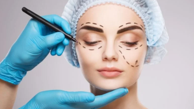 Looking to Refresh Your Eyes? What You Need to Know About Eyelid Surgery in Dubai